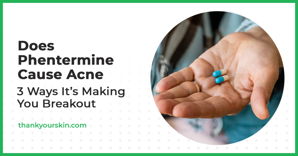 Does Phentermine Trigger Zits? (A Should-Learn!) Does Phentermine Trigger Zits? (A Should-Learn!)