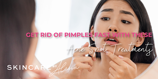 5 In a single day DIY Pimples Spot Therapies and Merchandise